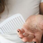 “Saç dökülmesi sorununuz varsa, genetik değil alışkanlıklarınız suçlu olabilir!”